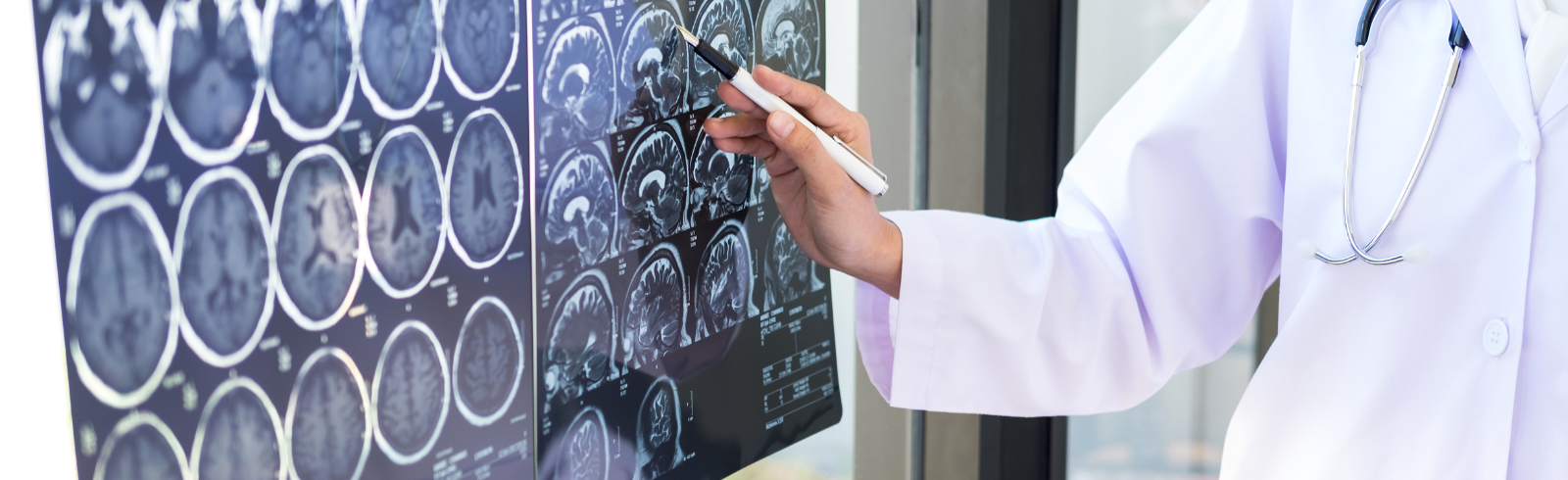Medical professional looking at brain scans